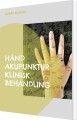 Hånd Akupunktur Klinisk Behandling - 