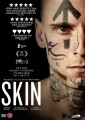 Skin - 