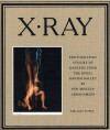 X-Ray - 