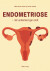 Endometriose - Når Underlivet Gør Ondt - Bog