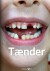Tænder - Bog