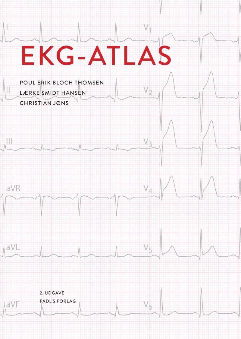 Ekg-atlas - Poul Erik Bloch Thomsen - Bog