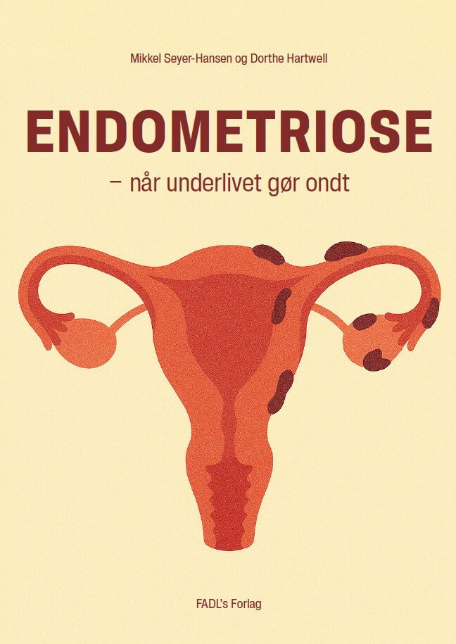 Endometriose - Når Underlivet Gør Ondt - Dorthe Hartwell - Bog - Fadls Forlag