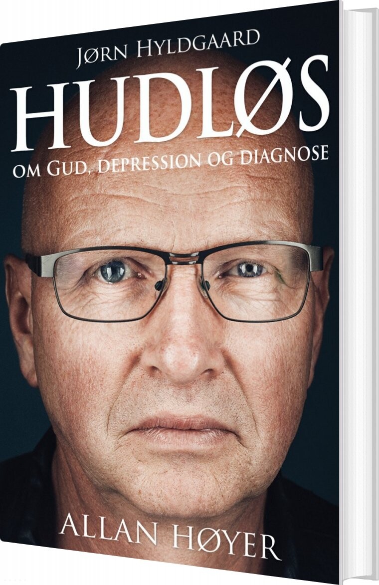 Billede af Hudløs - Allan Høyer - Bog