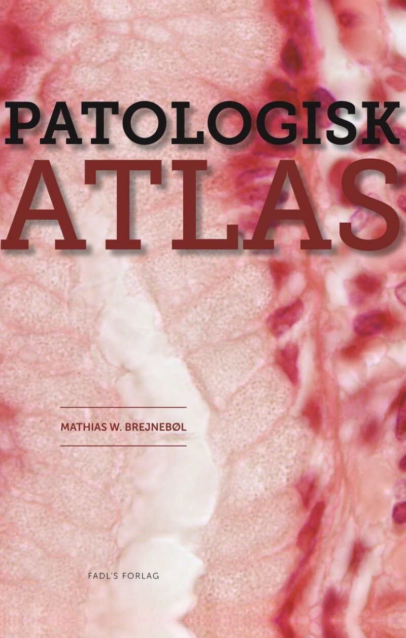 Patologisk Atlas - Mathias Willadsen Brejnebøl - Bog