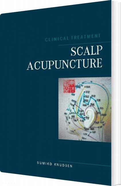 Billede af Scalp Acupuncture - Sumiko Knudsen - English Book