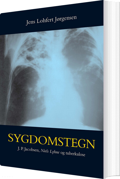 Sygdomstegn - Jens Lohfert Jørgensen - Bog