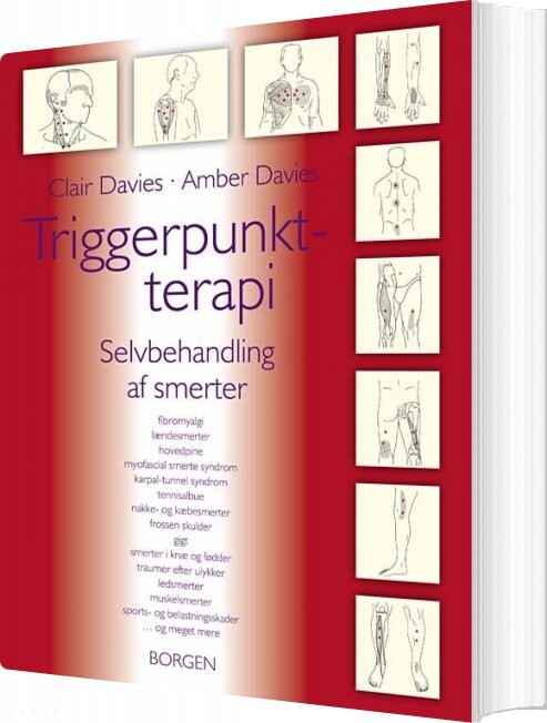 Billede af Triggerpunkt-terapi - Clair Davies - Bog
