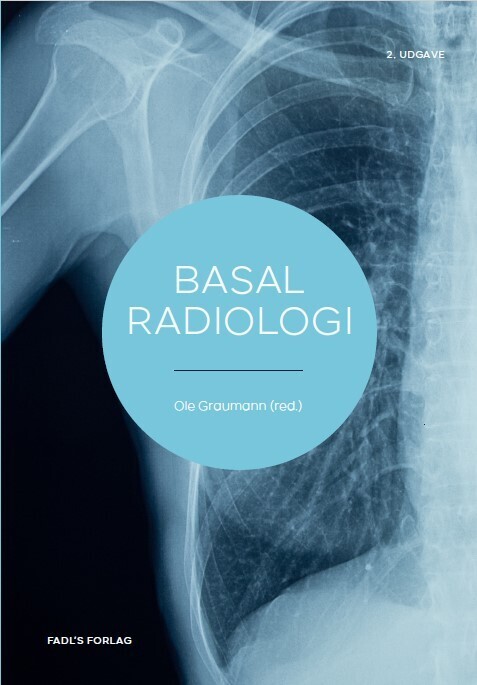 Basal Radiologi 2 Udg