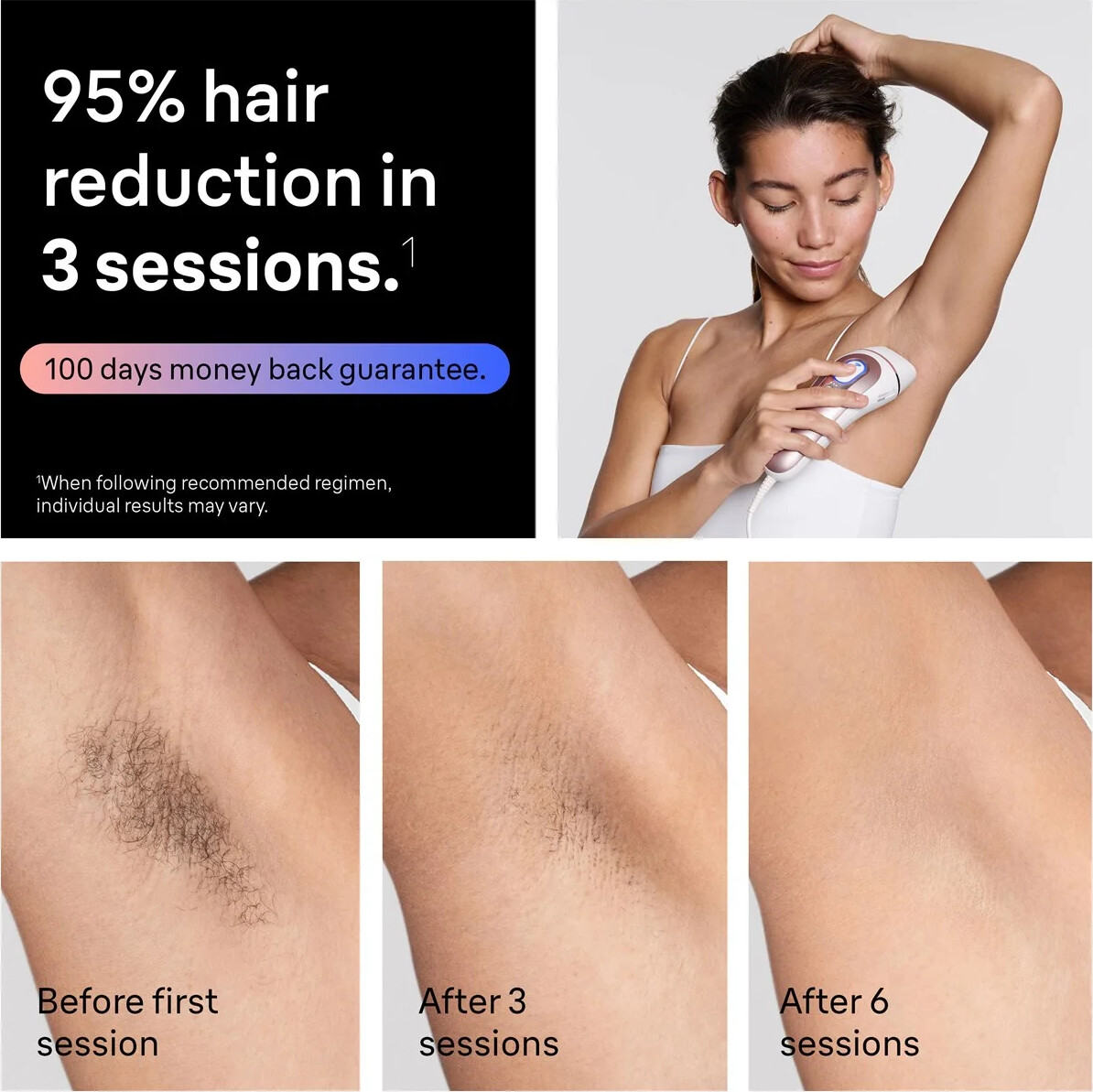 Braun - Smart Ipl Skin I Expert Hårfjerning Hjemme Med Gratis App 2 Smart