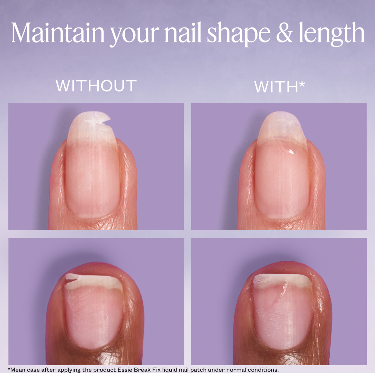 Essie - Breakfix Liquid Nail Patch - 7 Ml