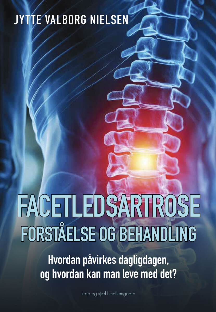 Facetledsartrose - Forståelse Og Behandling