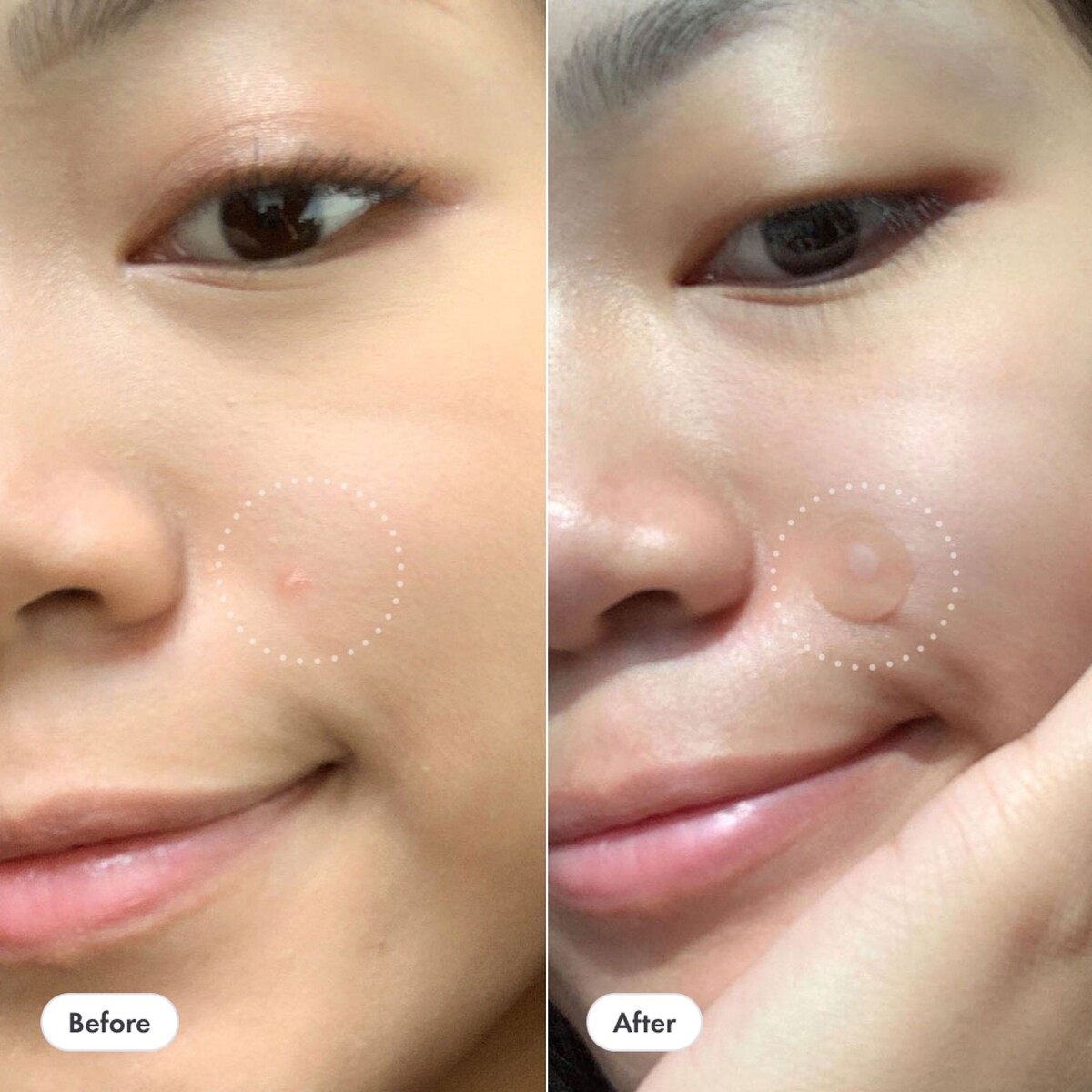 Hero Mighty Patch Invisible Plus 24Ct