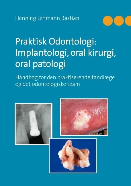 Praktisk Odontologi Implantologi Oral Kirurgi Oral Patologi