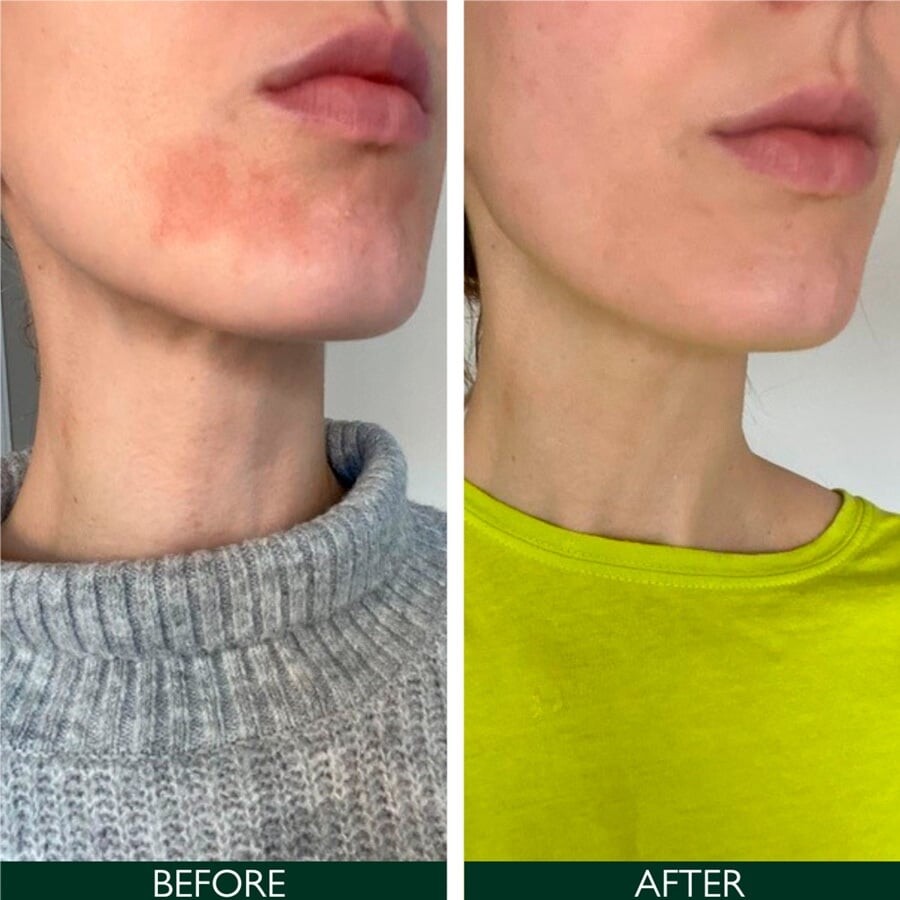 Sorted Skin - Intensive Rescue Face Lotion 50 Ml