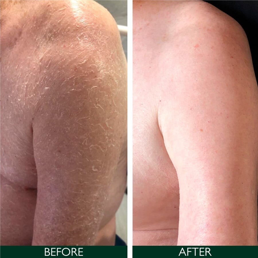 Sorted Skin - Intensive Rescue Moisturiser 100 Ml