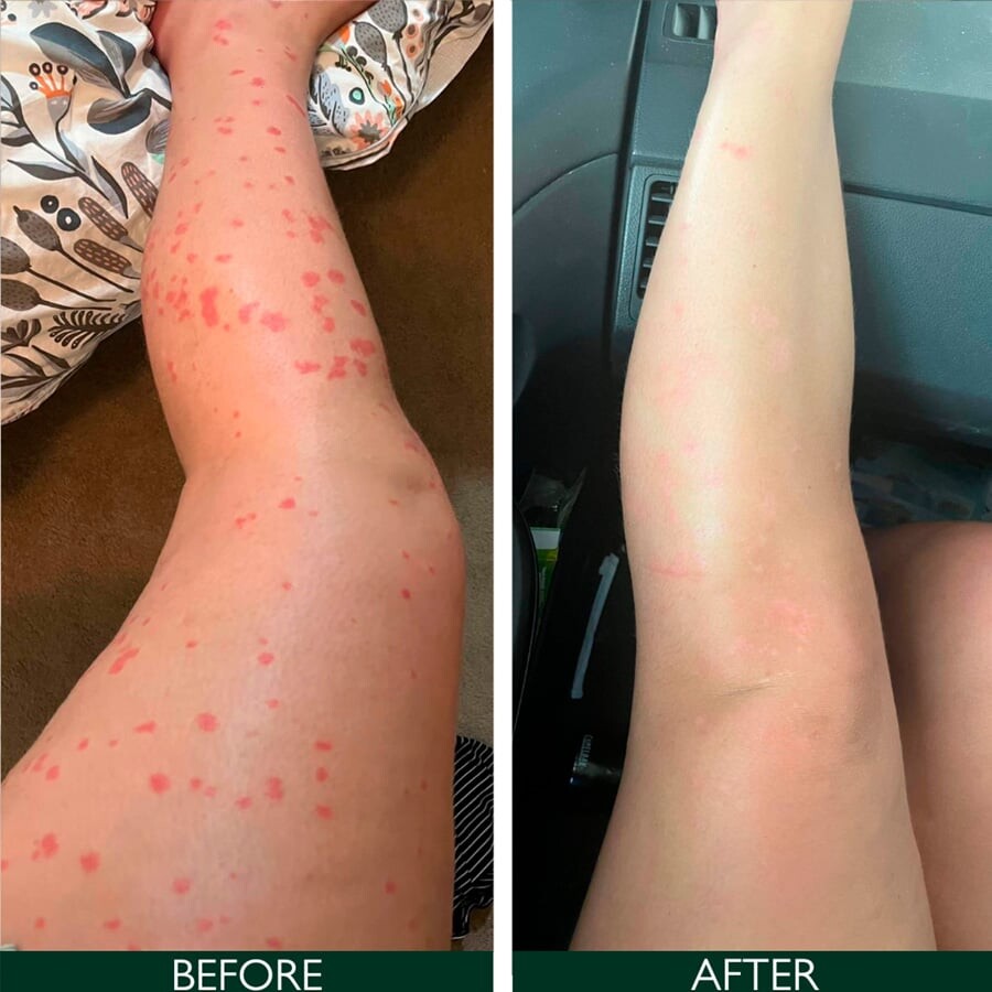 Sorted Skin - Intensive Rescue Spray 50 Ml