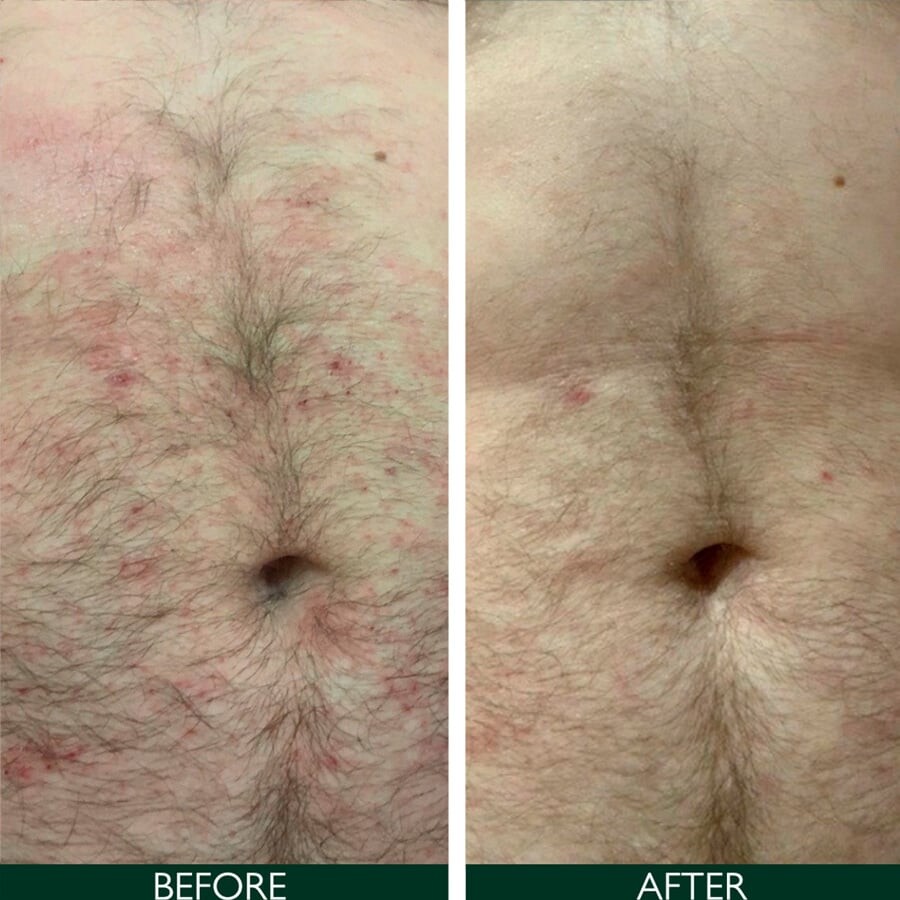 Sorted Skin - Intensive Rescue Spray 50 Ml