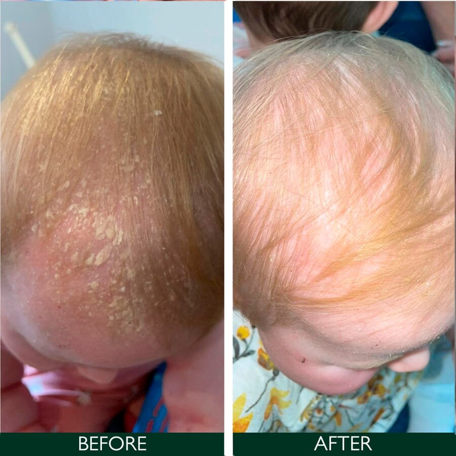 Sorted Skin - Intensive Rescue Spray 50 Ml