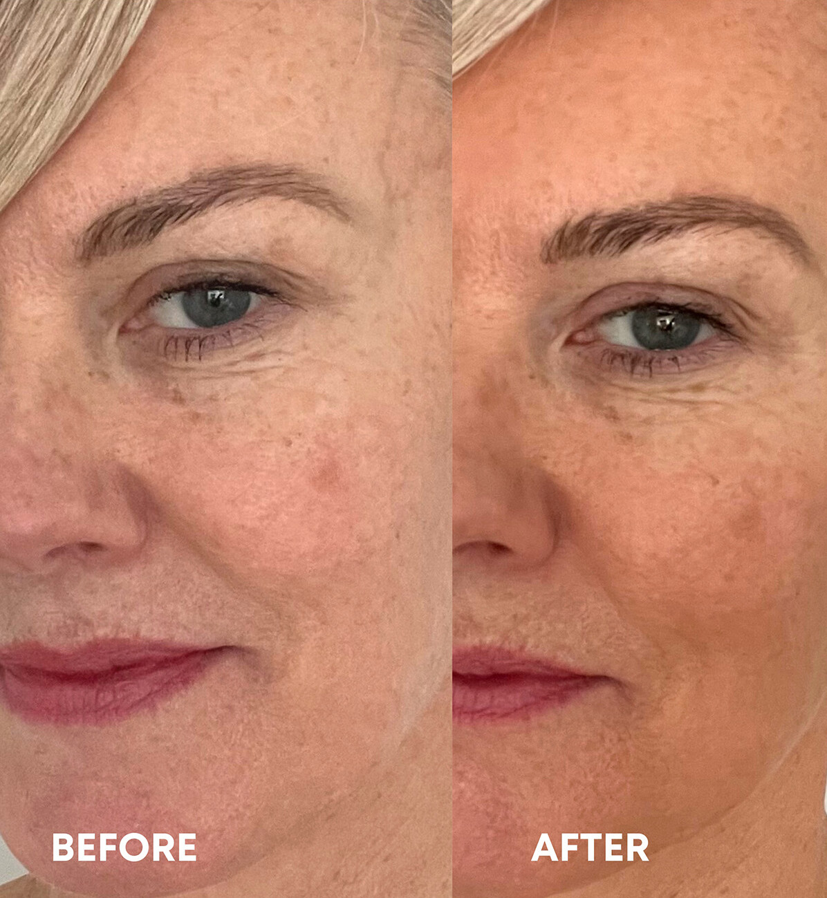 Vita Liberata - Self Tanning Anti-Age Serum - 15 Ml