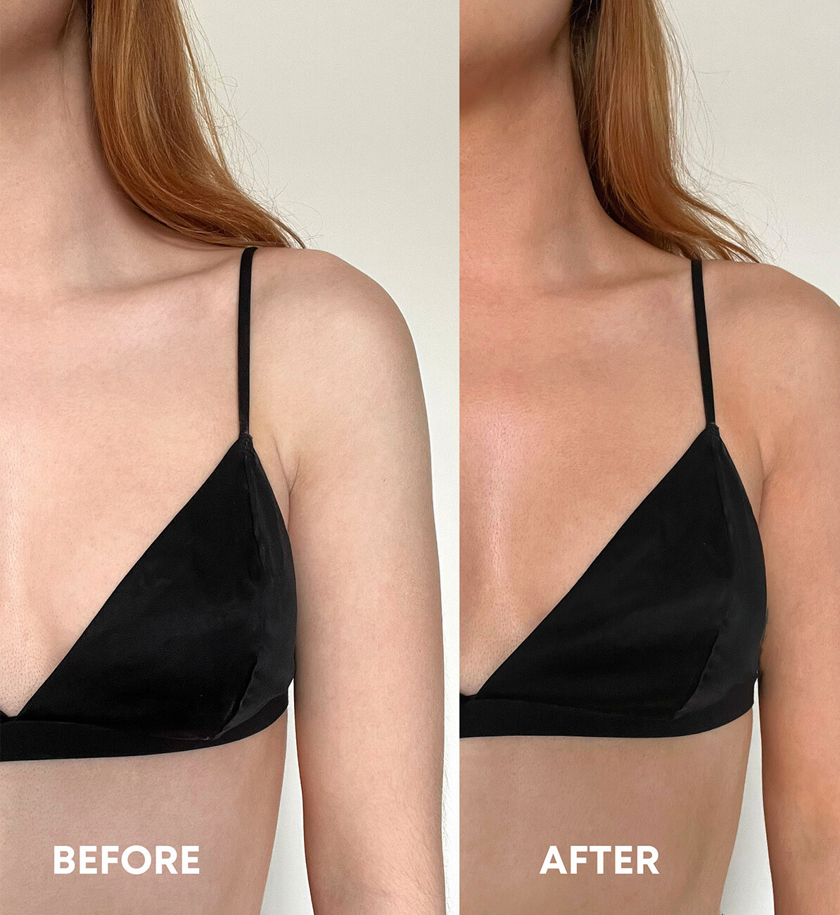 Vita Liberata - The Mousse - Medium