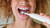 Philips Sonicare All-In-One - Hvid - 2 Stk Tandbørstehoveder